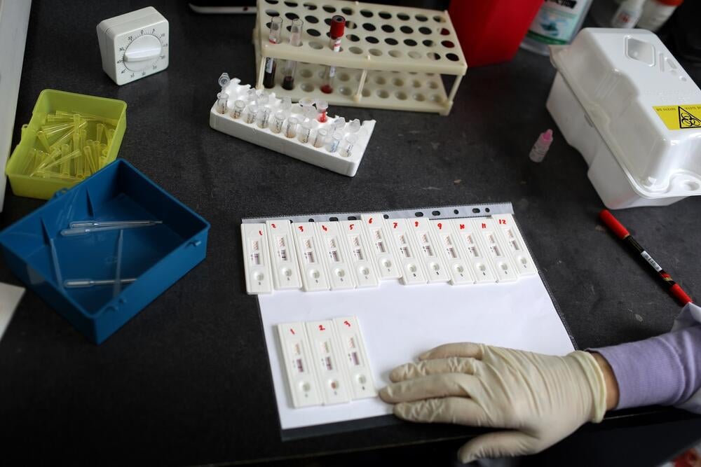 Several HIV tests are placed on the table waiting for HIV testing results