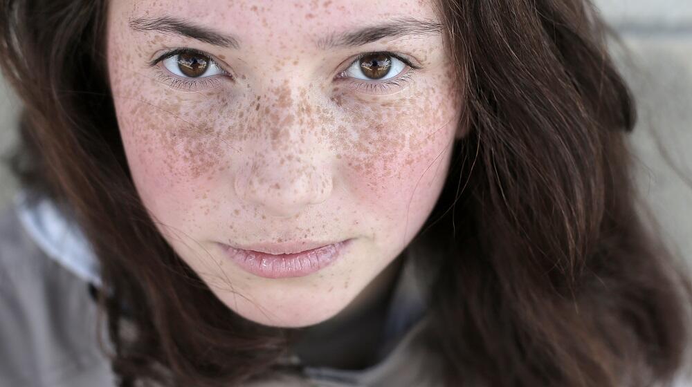 A girl with wrinkles on her face